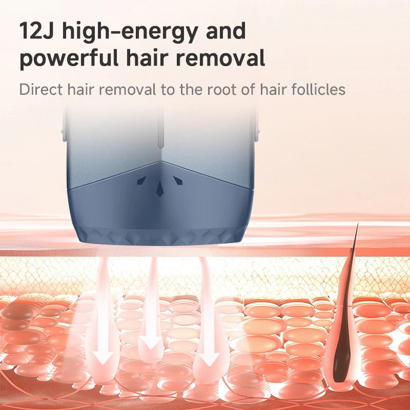 MLAY T18 IPL Laser Hair Removal Device for Home Use