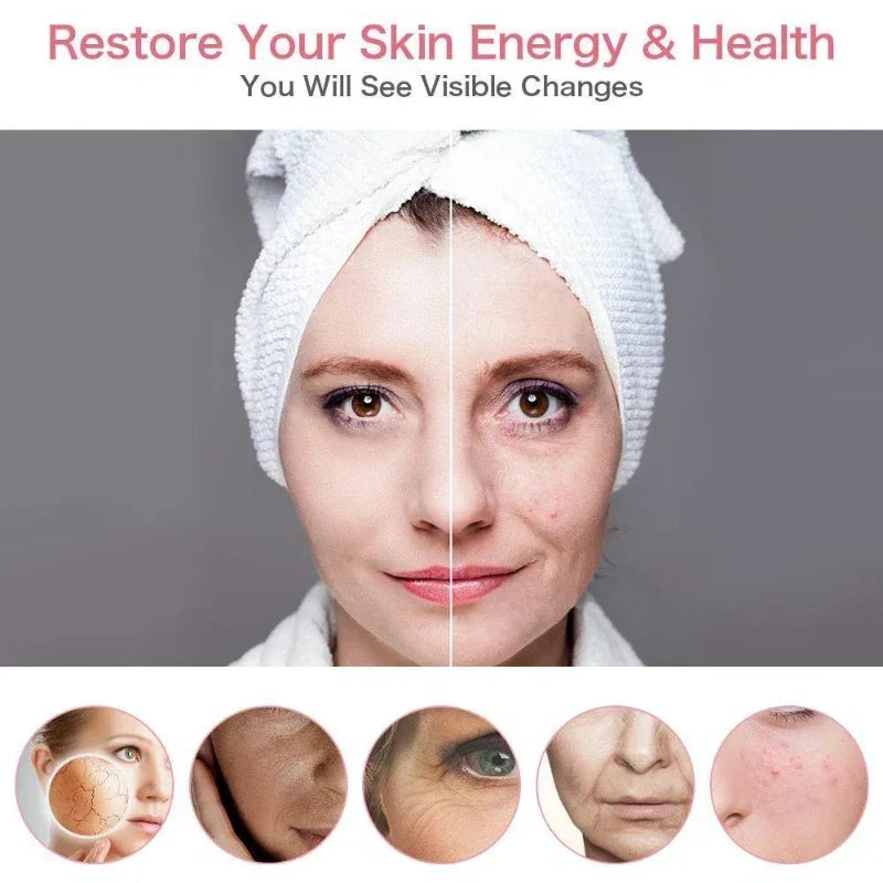 Zinc Alloy Microneedle Dermaroller For Facial Skin Care
