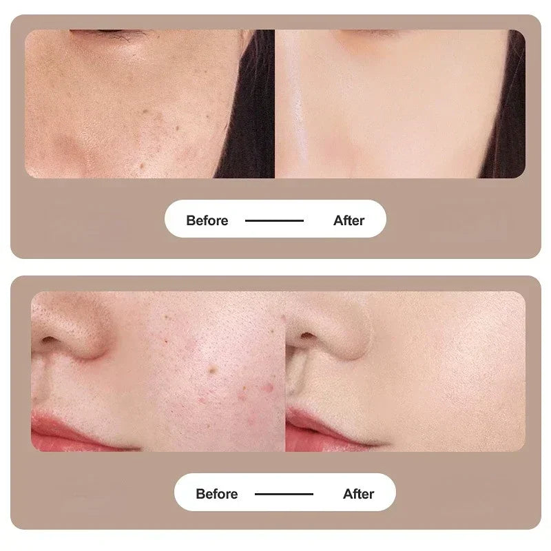 Zinc Alloy Microneedle Dermaroller For Facial Skin Care